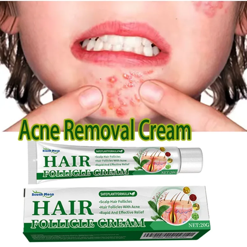 

Сыворотка от акне 07day с средством для удаления прыщей, сужающая поры, формула для баланса жирности кожи