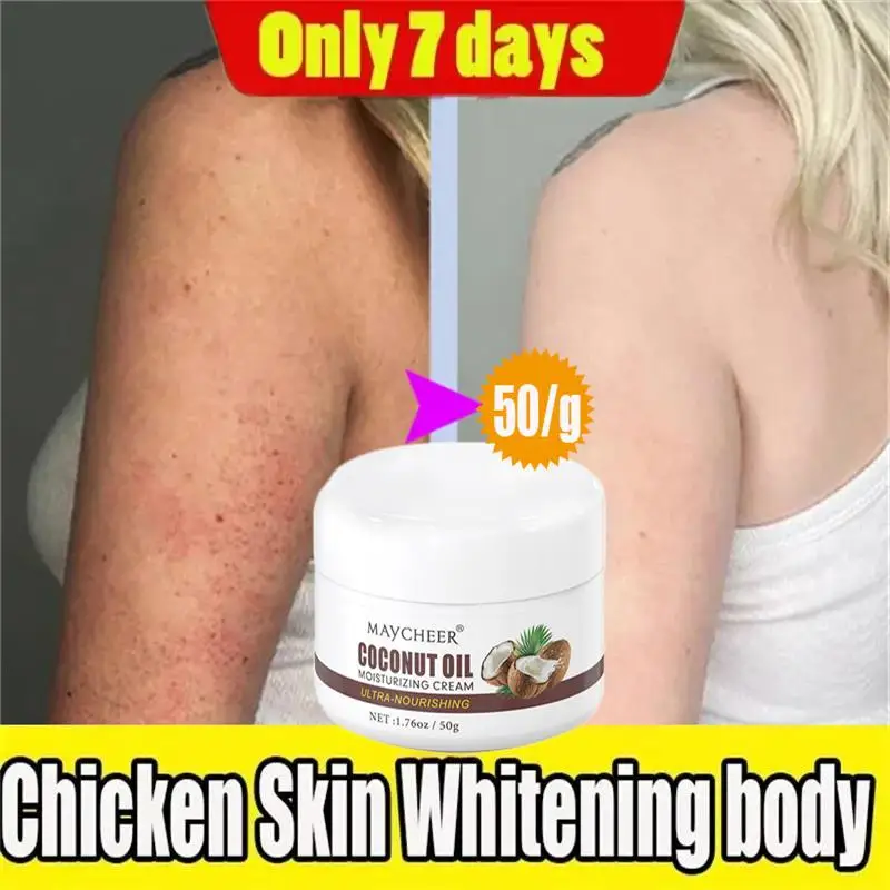 50g Keratosis Pilaris Repair Cream Chicken Follicle Skin Remove Body Dark Spot Smooth Body Lotion Moisturiz Whitening Dull Skin