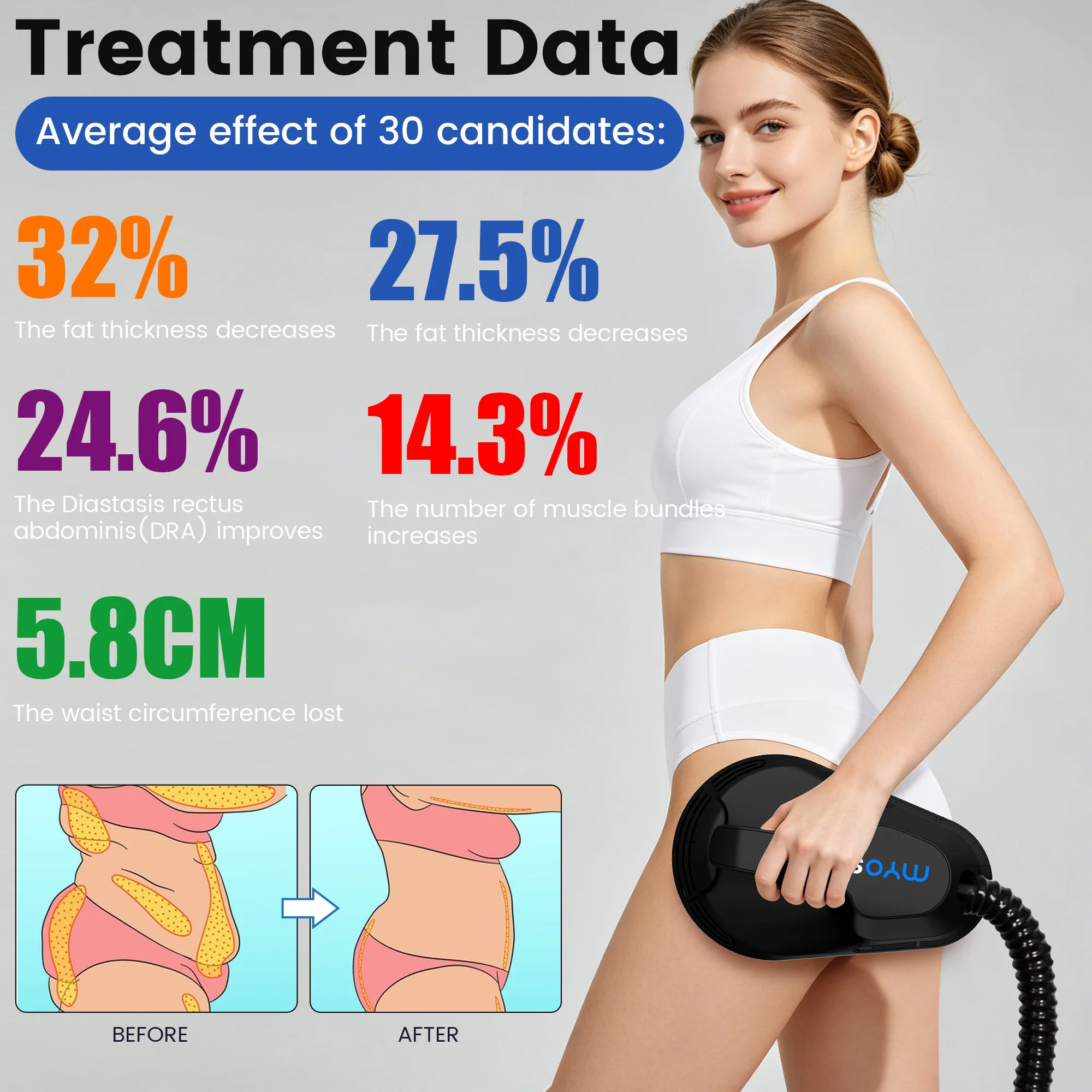 6500W High Power 4 Handles Myoslim EMS Body Sculpt Machine with Pure Copper Coil & 8 Language Touch Screen for Muscle Build Fat
