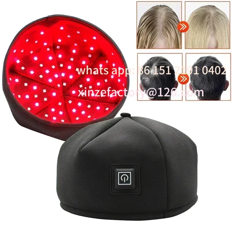 Customizable Hair Growth Cap Red Light Therapy  660nm 830nm Red Near Infrared Regrowth Hat Loss Treatment Helmet Scalp