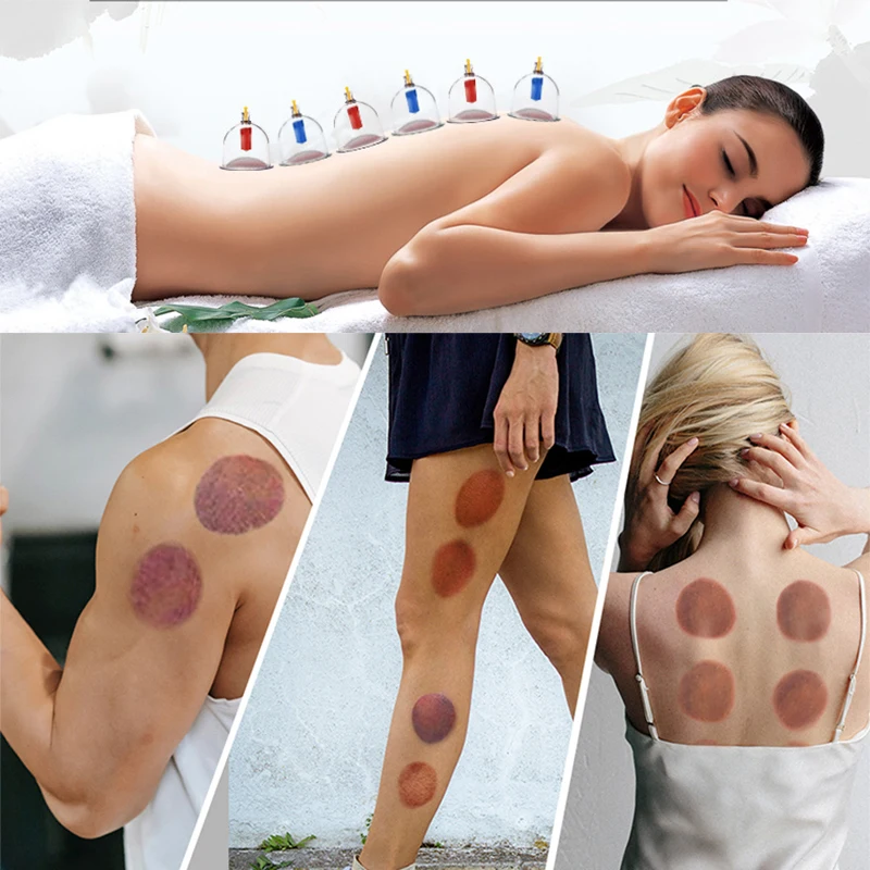 32/24/18/10/6 Cupping Therapy Set Vacuum Massage Tool Cupping Cup Massage Tool Set Ventosaterapia Masaje Profissional Copo