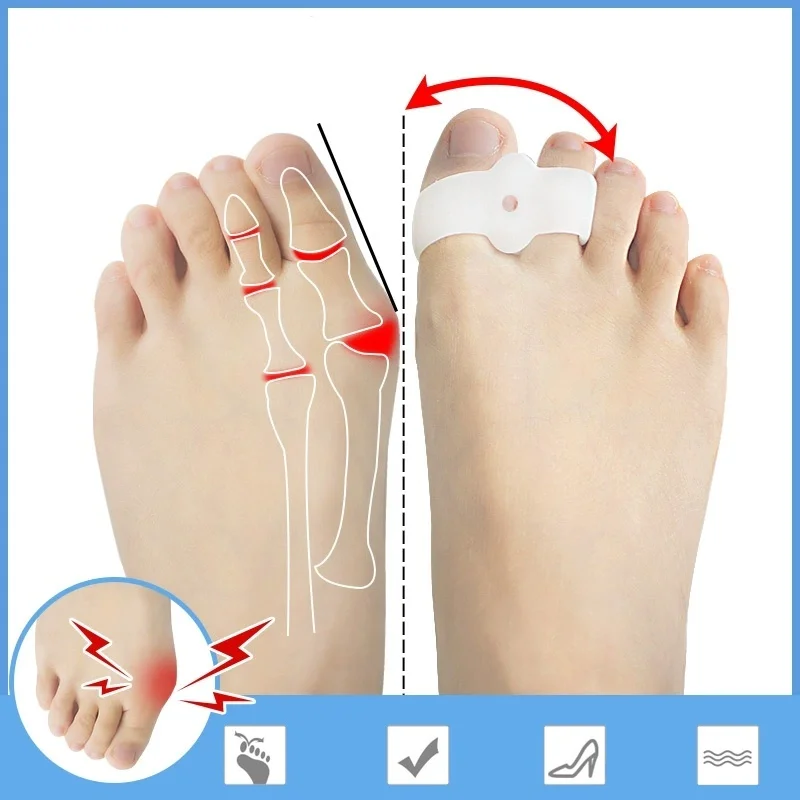 1 زوج الإبهام مستقيم أصابع فاصل أروح الورم مصحح أداة العناية بالقدم لجهاز تصحيح أروح الباديكير #2