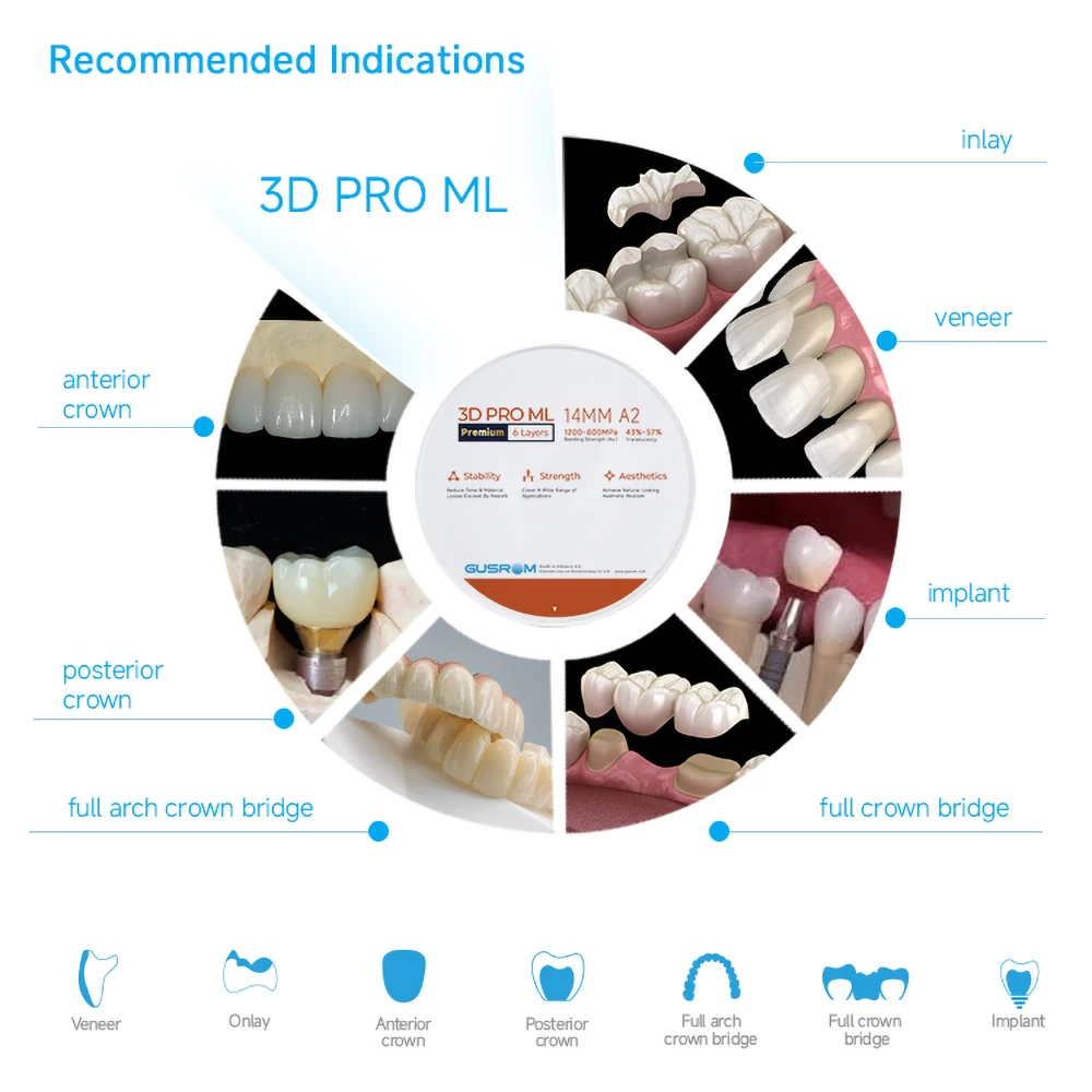 Fotografia 6: GUSROM 3D PRO ML Bloco de Zircônia Multicamadas Premium 98x16mm 6 Camadas Disco de Zircônia Dental Material CAD/CAM para Coroa, Ponte e Veneer