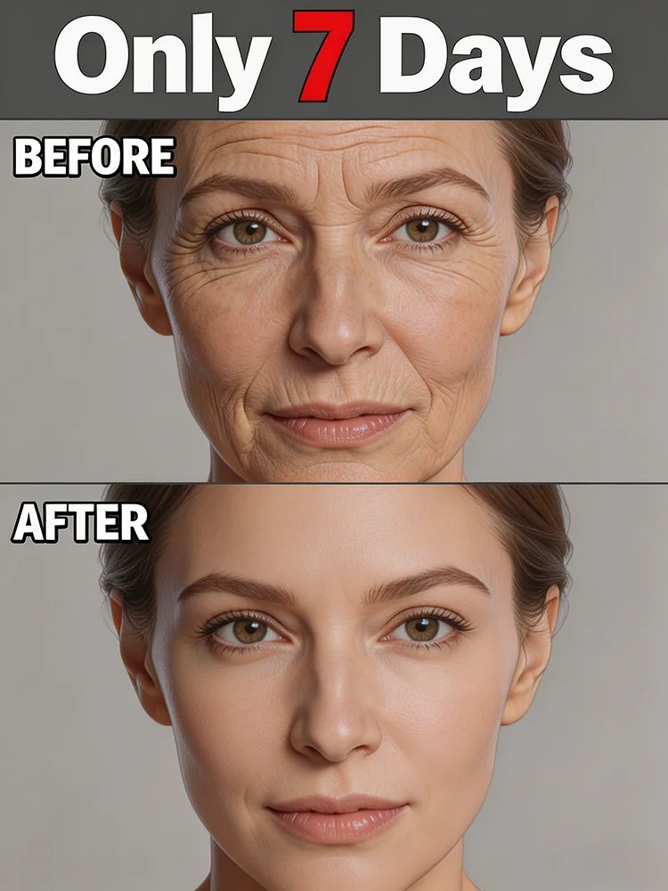 

Natural plant extract anti-wrinkle serum, No fine lines ,For wrinkles and does not look old For Smooth Delicate Complexion