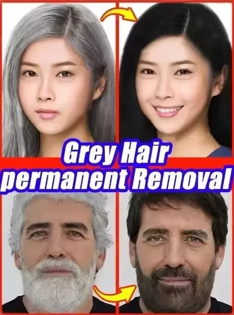 Natürliches Anti-Grau-Haarserum |   Nährende Haarpflege-Rare – repariert weißes und dunkelndes Haar