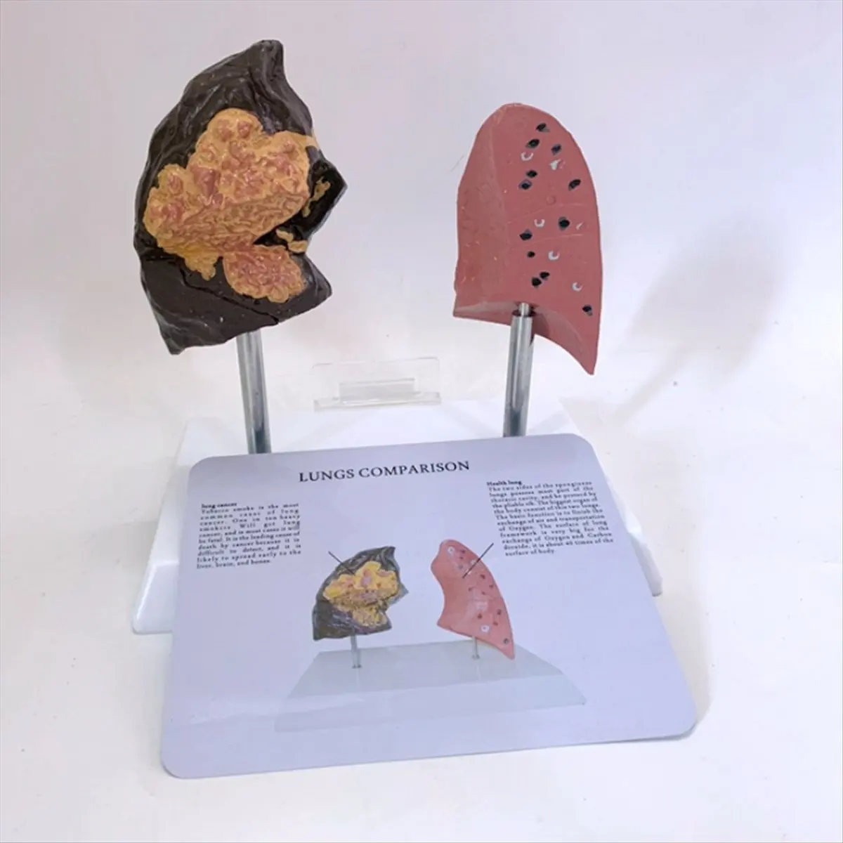 Eco-friendly Smoker'S Lung Model Healthy Lung Model Lung Anatomy Model with Pathological Respiratory System Disease Lungs