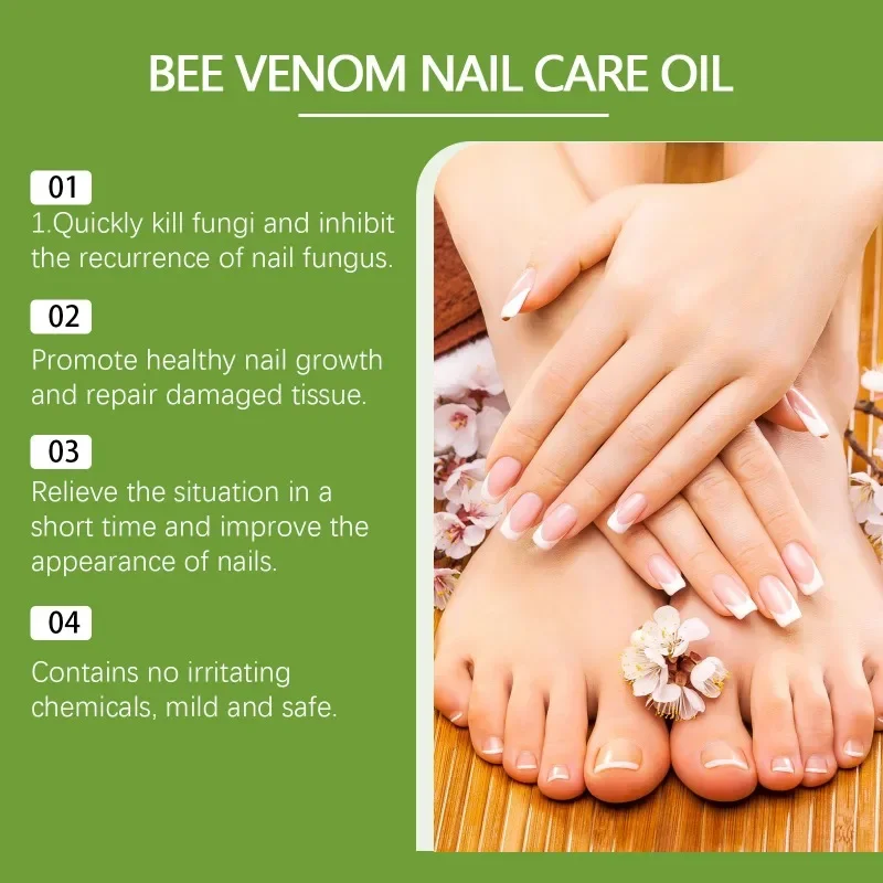 Nail Care Oil Foot Toe Nail Fungus Removal Essential Oil Anti Infection Onychomycosis Paronychia Repair Nutritional Care Serum