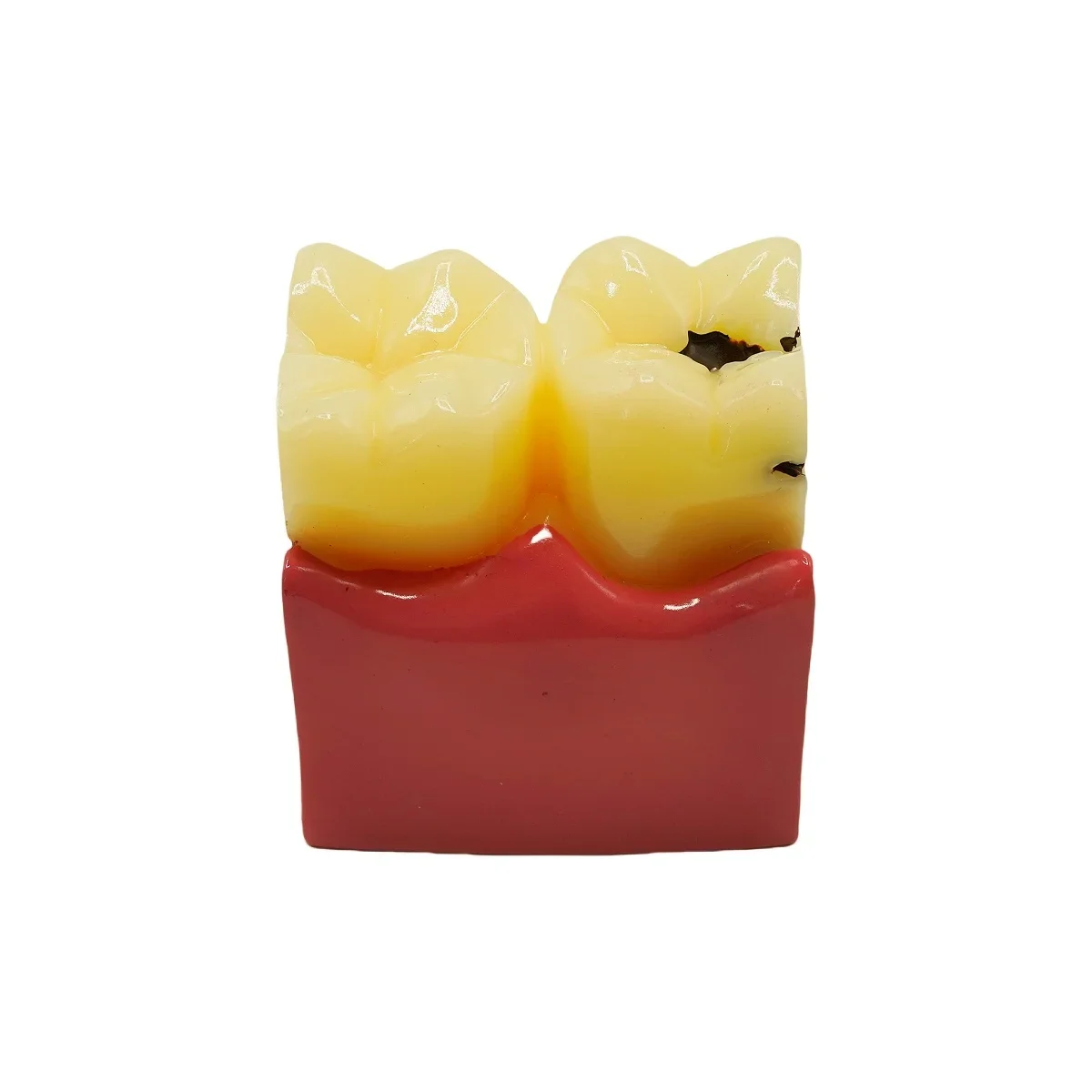 Thumbnail 4 - #7 Best Dental Teaching Models to Buy In 2026