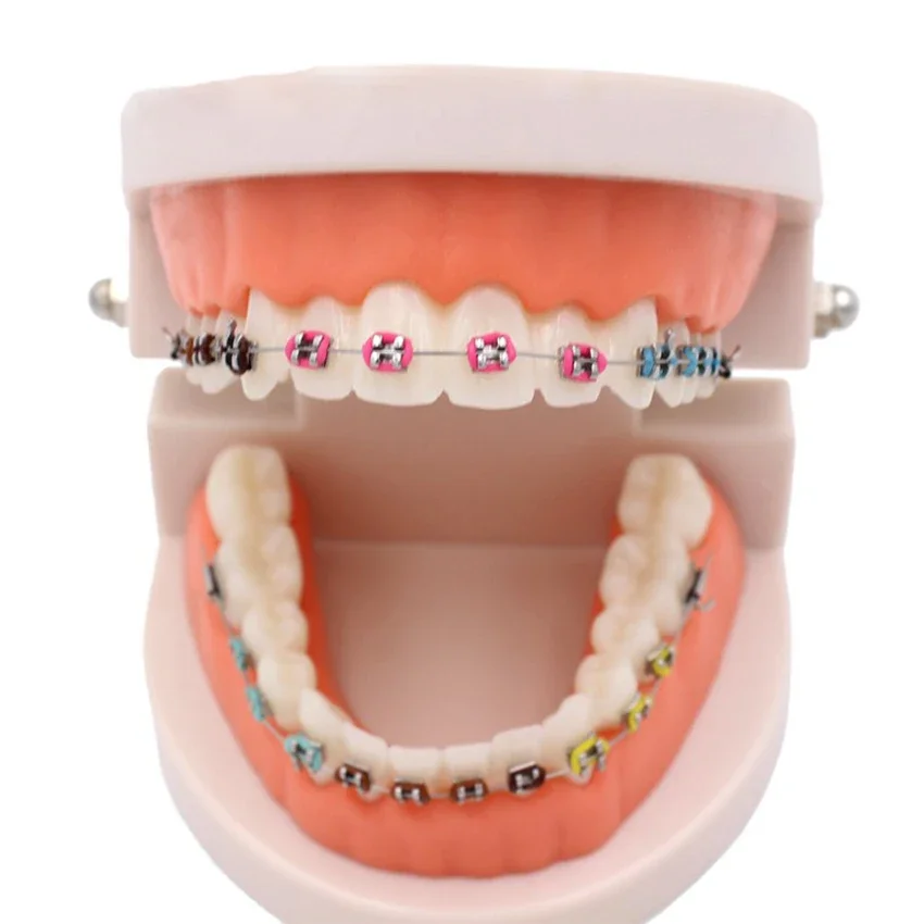 

Dental Orthodontic Treatment Model with Ortho Metal Bracket Arch Wire Buccal Tube Ligature Ties