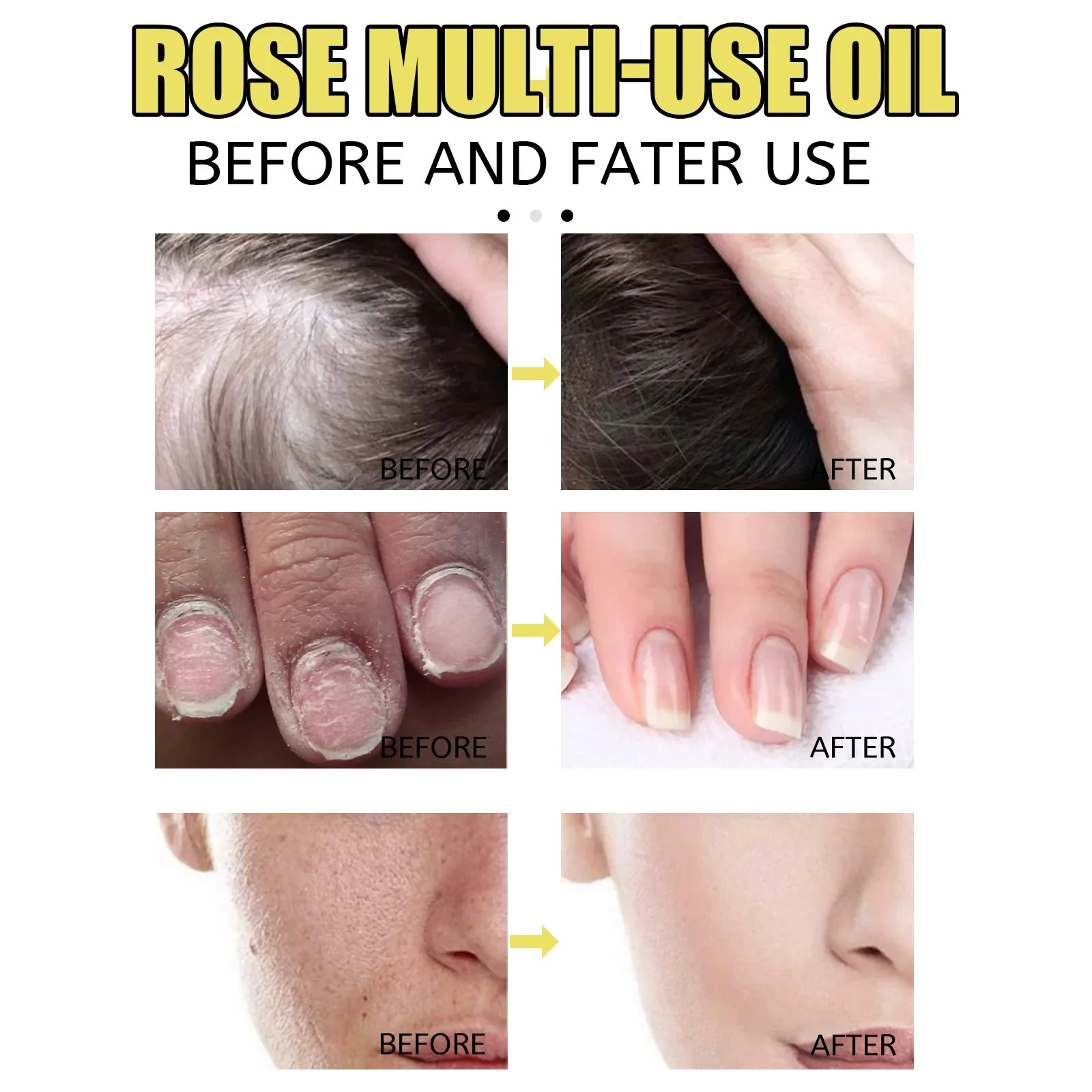 Eelhoe Rose Pets Essential Oil Skin Skin Hair Care Foot Anti-Chapping Multi-Effect Care Oil Intensive Repair Damaged Skin