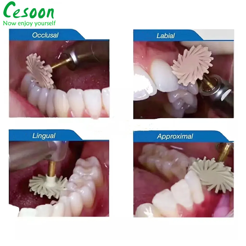 6 sztuk/zestaw dentystyczny zestaw do tarcza do polerowania z żywicy kompozytowej gumowa polerka diamentowa spiralna szczotka do zębów higiena jamy ustnej stomatologii