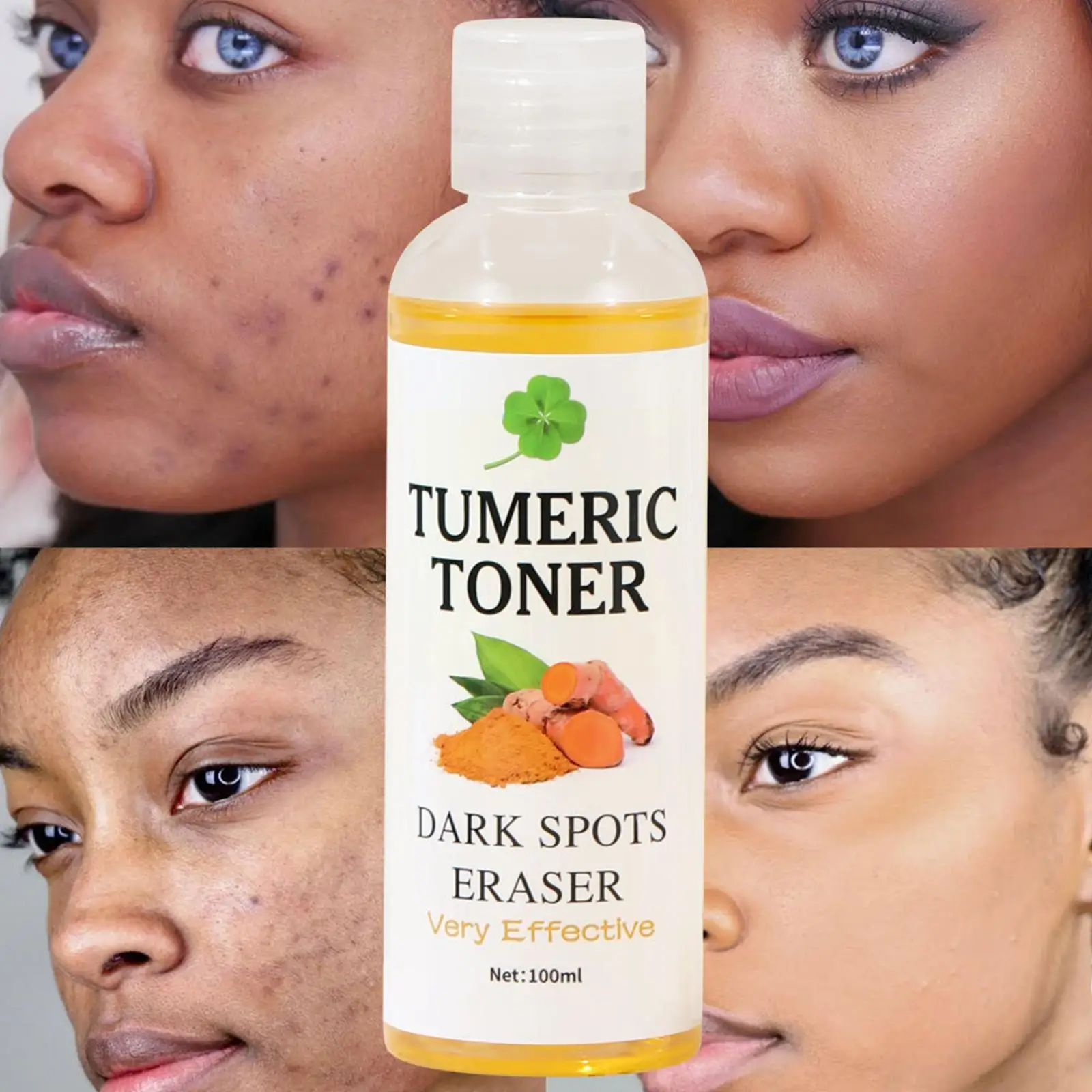 100Ml Tumeric Donkere Vlekken Toner Gum Corrector Kurkuma Verwijderaar Acne Verhelderende Donkere Verwijderaar Hydraterende Vlekken Toner E8a4