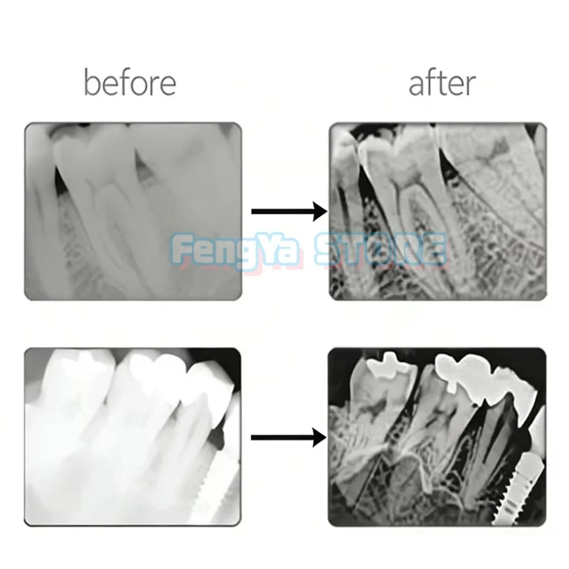 1 Set Original Runyes Dental Digital X-Ray RVG Sensor DR730 Intraoral X ray Sensor Imaging System  Dental Digital X Ray Sensor