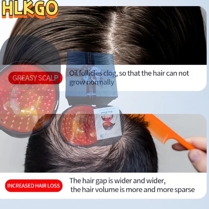 

HLKGO 96 Laser Hair Therapy Cap Medical Grade LLLT Treatment for Fast Hair Growth & Oil Control