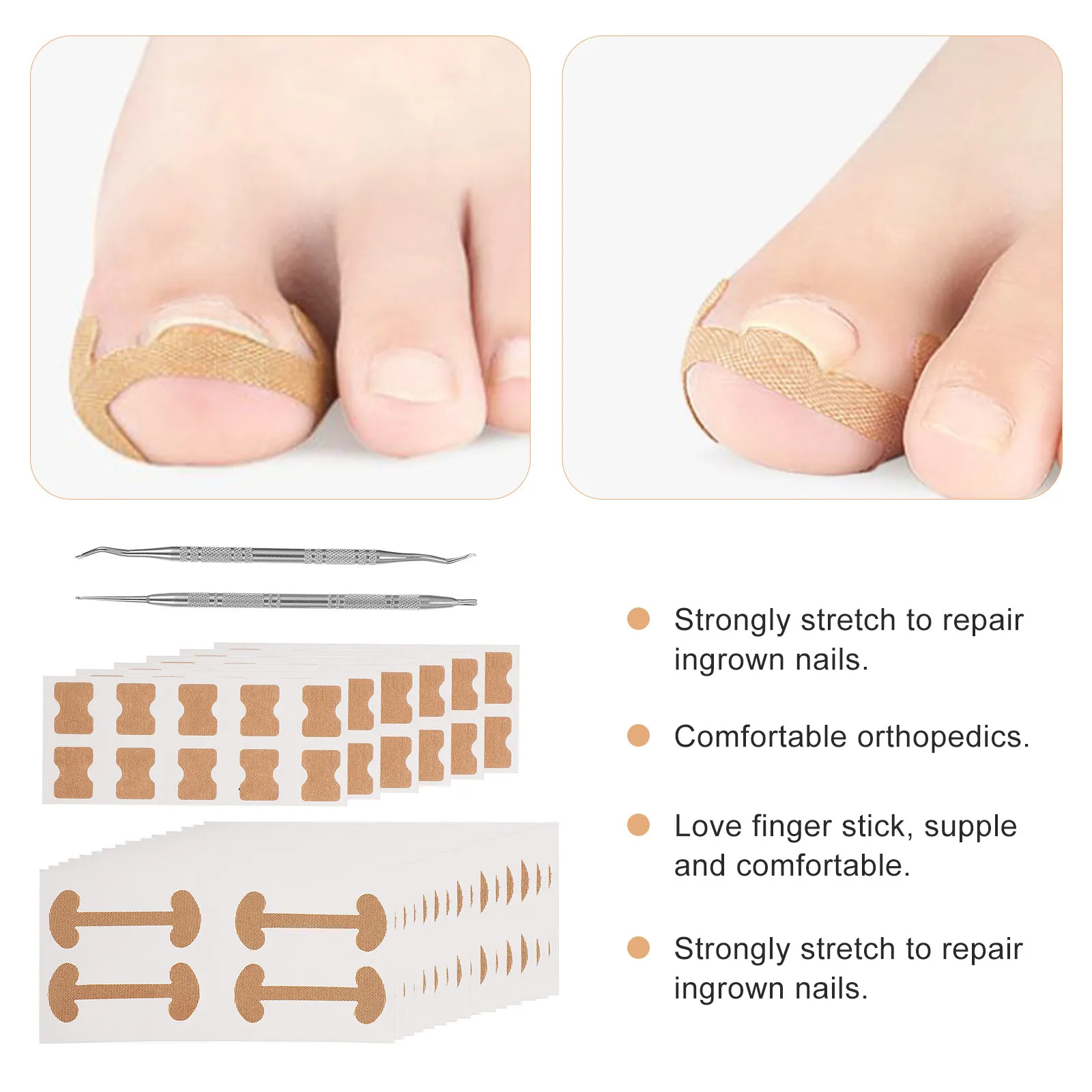 

Набор пластырей для коррекции вросших ногтей: быстродействующие патчи для восстановления ногтей, инструменты для коррекции ногтей на ногах, полоски для облегчения боли