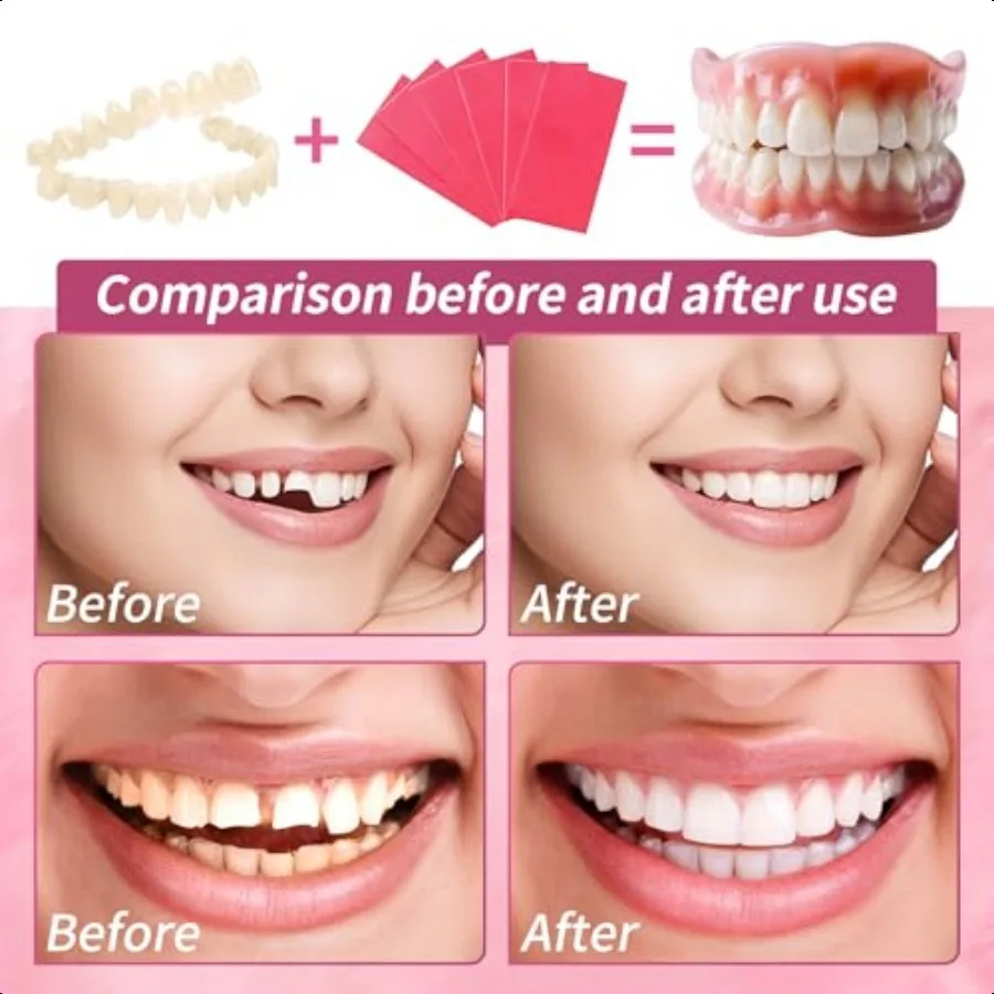 Dentadura postiza, juego completo de dientes postizos superiores e inferiores para Imp Smile, Kit de bricolaje, reparación de dientes postizos fácil y práctica, Missin