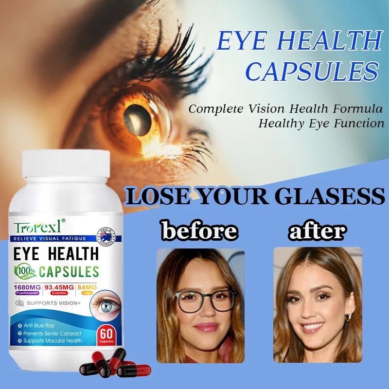 

Improve Eyesight Capsules Lutein - Protect Eyesight Prevent Myopia Relieve Eye Pressure Fatigue Dryness Removal Discomfort