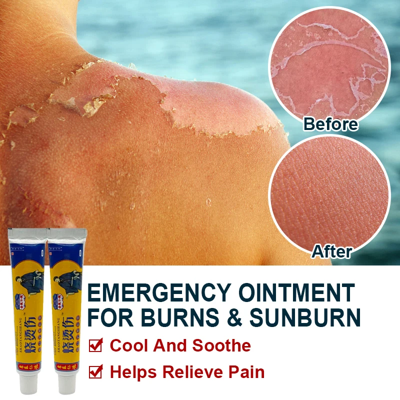 20g Scald Burn Cream Cooling Soothing Burns First Aid Wound Care Medicine Herbal Bacteriostatic Scald Burn Skin Care Cream