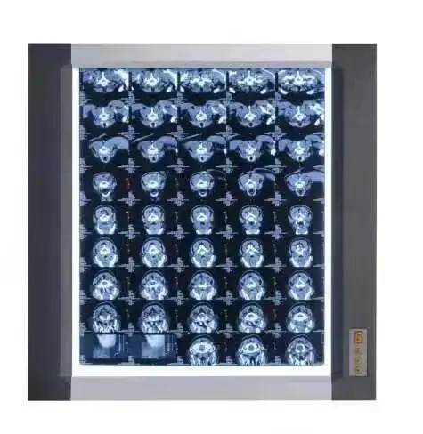 High Quality Led Professional View X Ray Film Medical Hospital Scanner Box Negatoscope X-ray Film Viewer