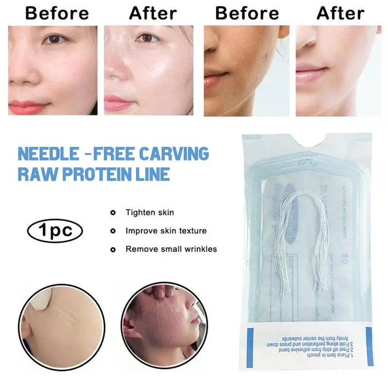 Absorbable No Needle Protein Thread Gold Protein Line Anti-wrinkle Face Lift Filler Women Beauty Skin Collage Protein Serum