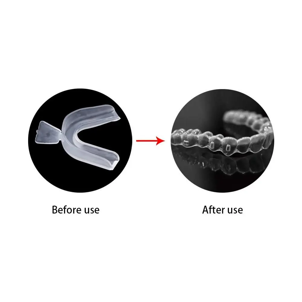Sleep Aid Bruxism Tooth Braces Teeth Covers Stop Teeth Grinding Guard Mouth Tray Teeth Whitening Boxing Protection Mouth Guard