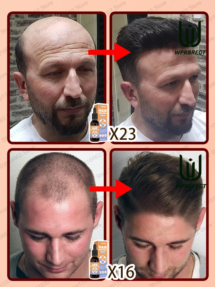 Hot sale, more hair. Say goodbye to baldness, the secret to thick hair,Grow hair anywhere.