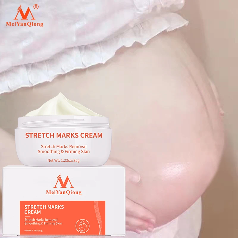 Postpartum repairing body cream, can remove stretch marks and postpartum scars, with a gentle texture and delicate texture