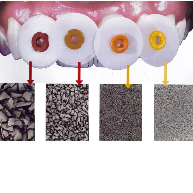 40pcs 12.5mm 9.5mm Polishing Wheels Dental Composite Resin Finishing Discs Four Roughness Types Translucent Design Oral Material