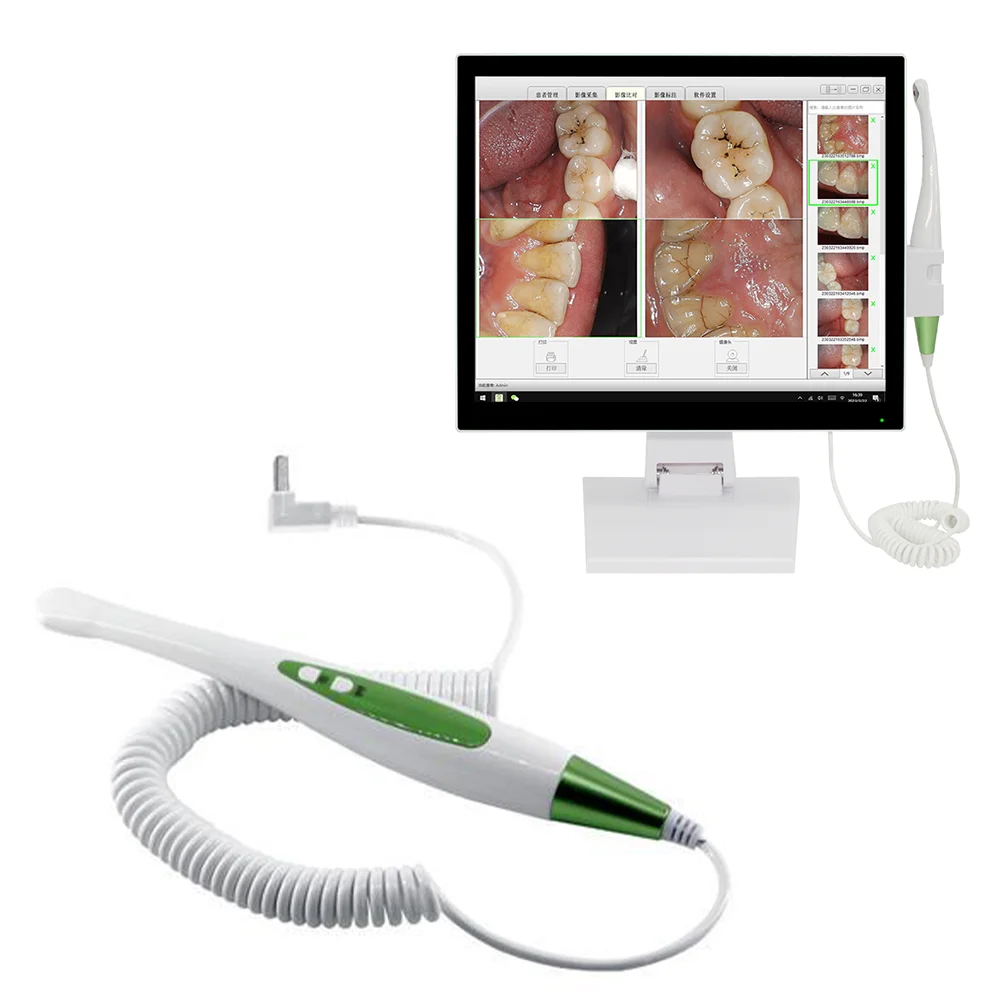 Dental INTRA ORAL CAMERA scanner Wireless wifi Endoscope all-in-one HD 17 inch Touch Screen Monitor Connect with Dental Chair