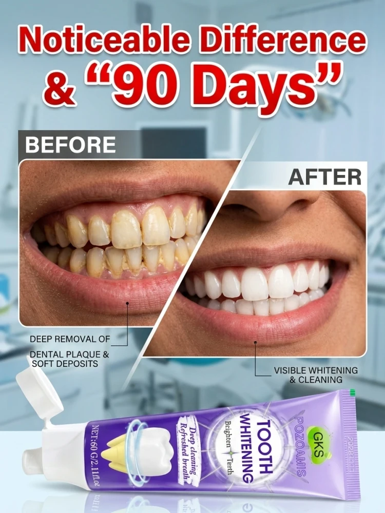 Mild Whitening Toothpaste for Daily Oral Maintenance, Effectively Cleans Soft Plaque and Surface Stains on Teeth, Delivers All-day Fresh Breath, Keeps Beautiful Bright Teeth Look