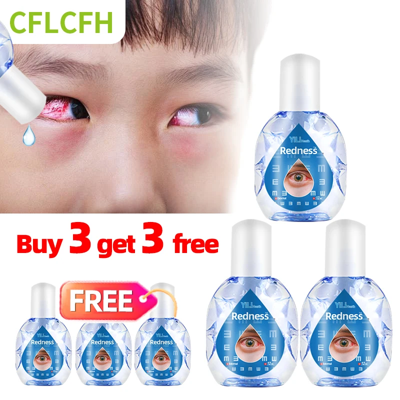 

6Pcs Red Eyes Removal Treatment Eye Drop Visual Fatigue Eye Discomfort Dry Eyes Pain Excessive Eye Use Protect Vision Care Drops