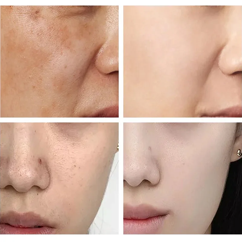 SPF90 + Crema solare coreana sbiancante per il viso Anti UV Blocco solare Siero idratante delicato per il viso Adatto per prodotti per la pelle sensibile