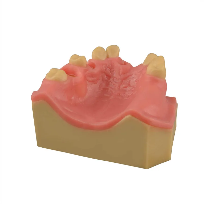 

Dentals training exercises Maxillary sinus training Model exercises