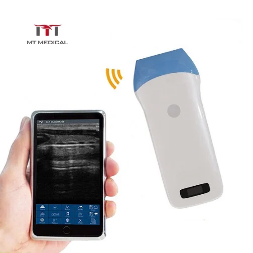 4G/5G Wifi Portable 128 Elements Linear Probe Wireless Ultrasound USG For Android&IOS&Windows