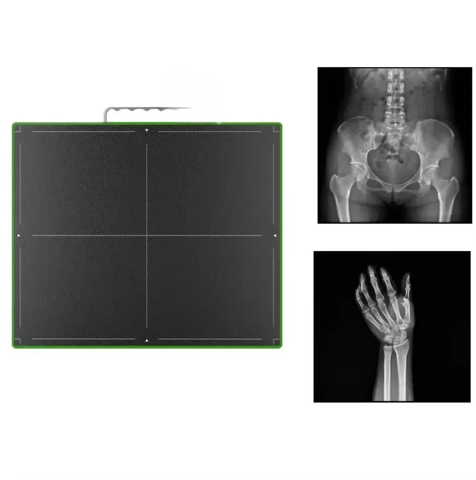 Veterinary high-quality flat panel detectors for x-ray veterinary equipment Digital x-ray flat panel detectors