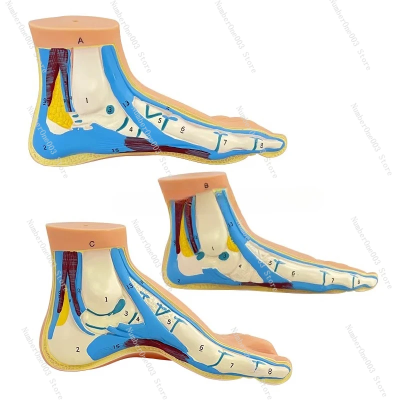 

Анатомическая модель стопы, нормальная плоская арка, структура стопы, мышцы, сосуды, медицинское обучение
