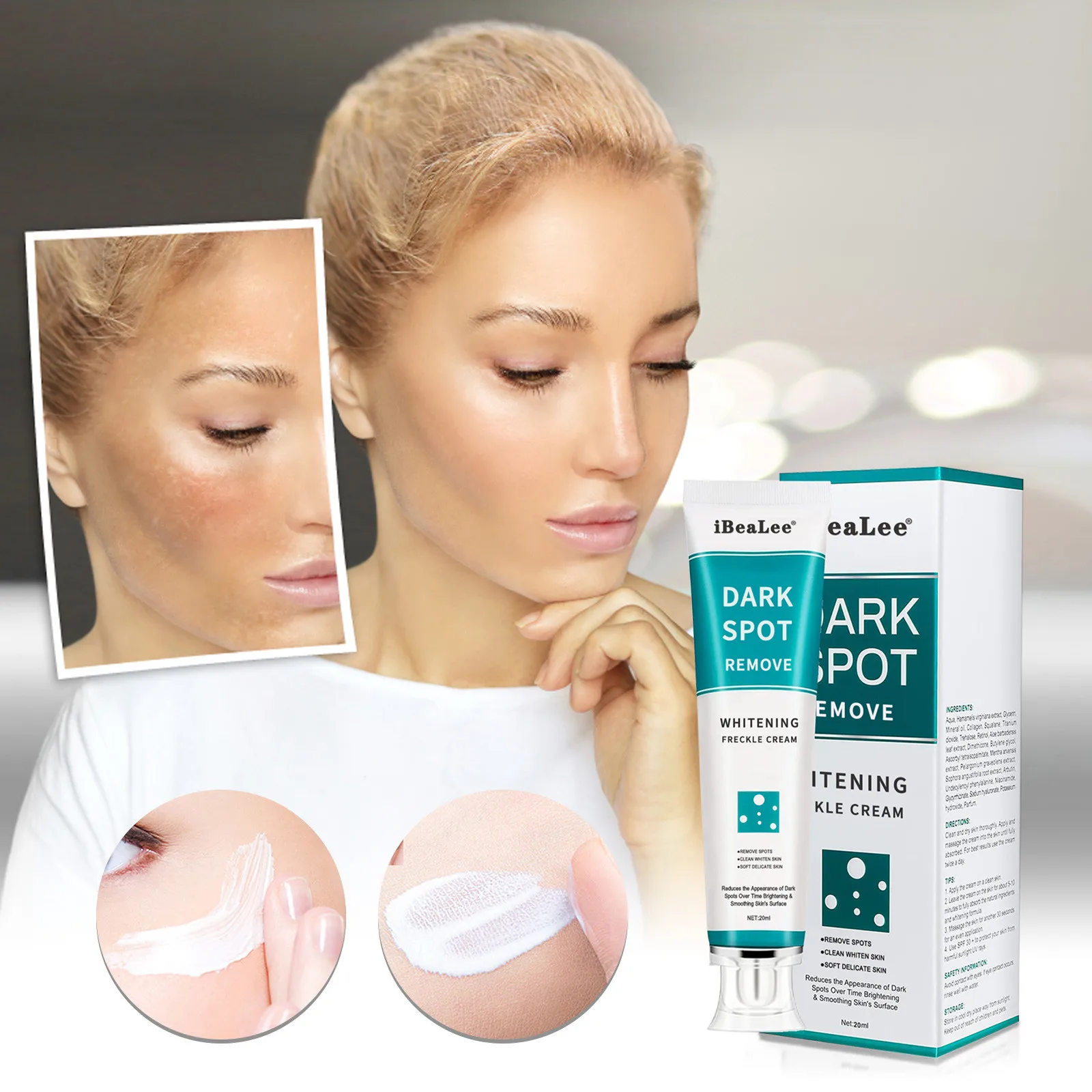 

Dark Stripe Remover | Brightening & Lightening | Pimple Marks | Acne Mark | Uneven Skin Tone | Pigmentation & Flaw Removal