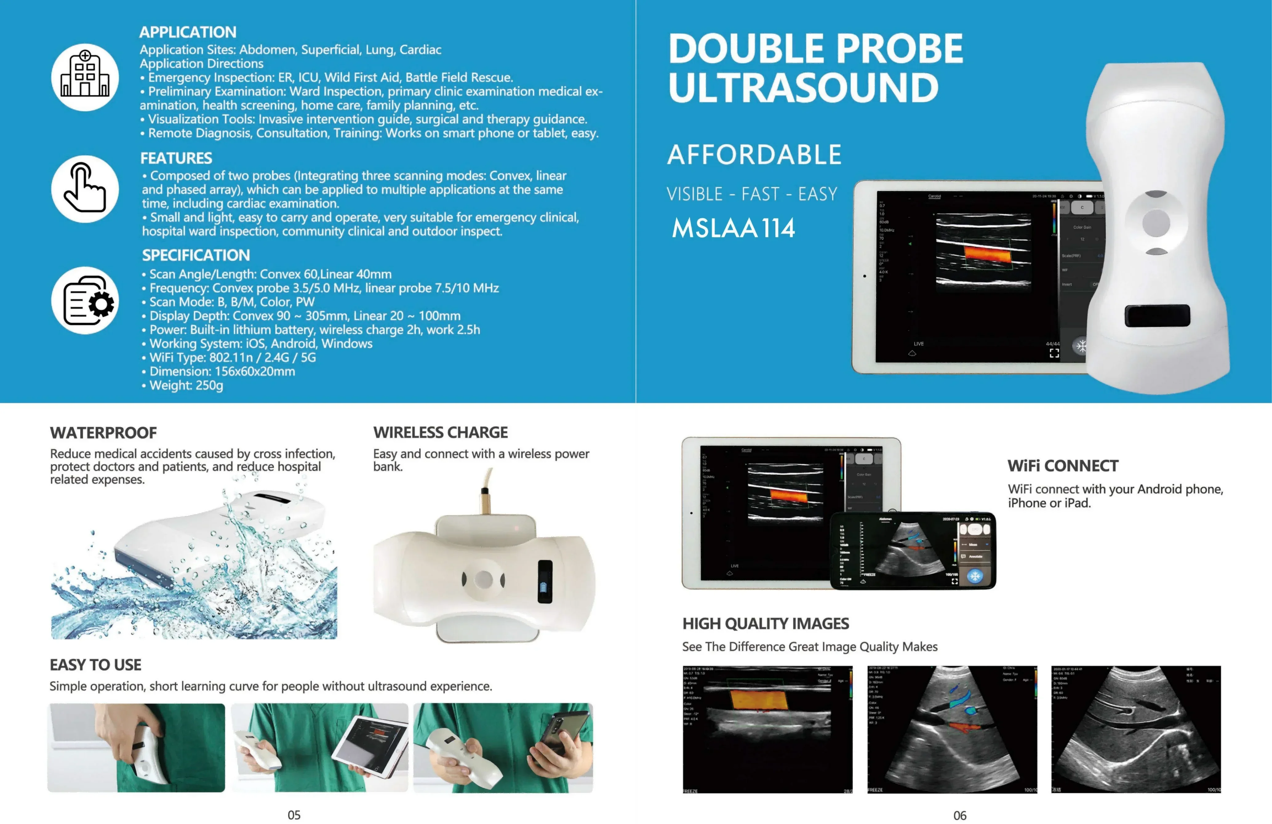 Portable Wireless Mini Ultrasound Diagnostic Equipment with Electric Power Source for Bladder Probe Medical Use