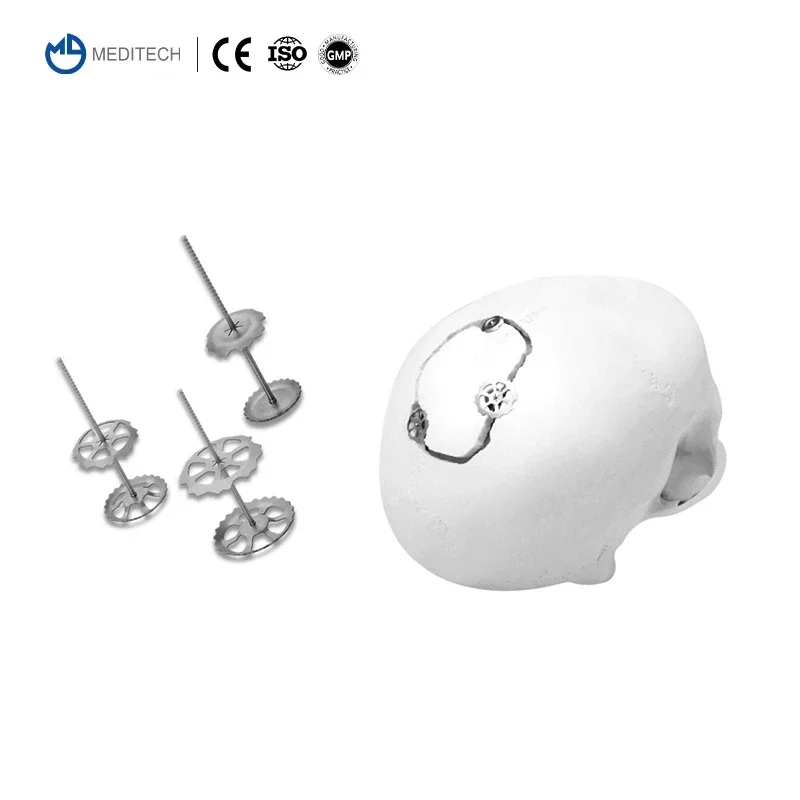 MEDITECH Chirurgisch Maxillofacial Neurochirurgie Systeem Cranial Titanium Mesh Plaat voor Schedel Cranioplastie
