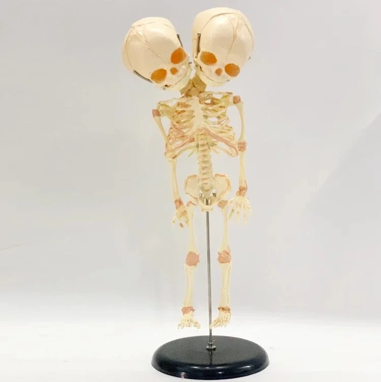Free Ship Human Double Head Baby Skull Skeleton Anatomy Brain Display Study Teaching Anatomical Model Halloween Bar Ornament
