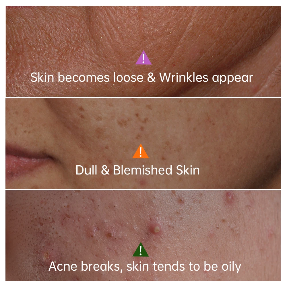 JoyPretty Vitamin C Collagen Face Serum Dark Spots Remover Anti Aging Pore Shrink Moisturizing Serum Facial Skin Care Cosmetics