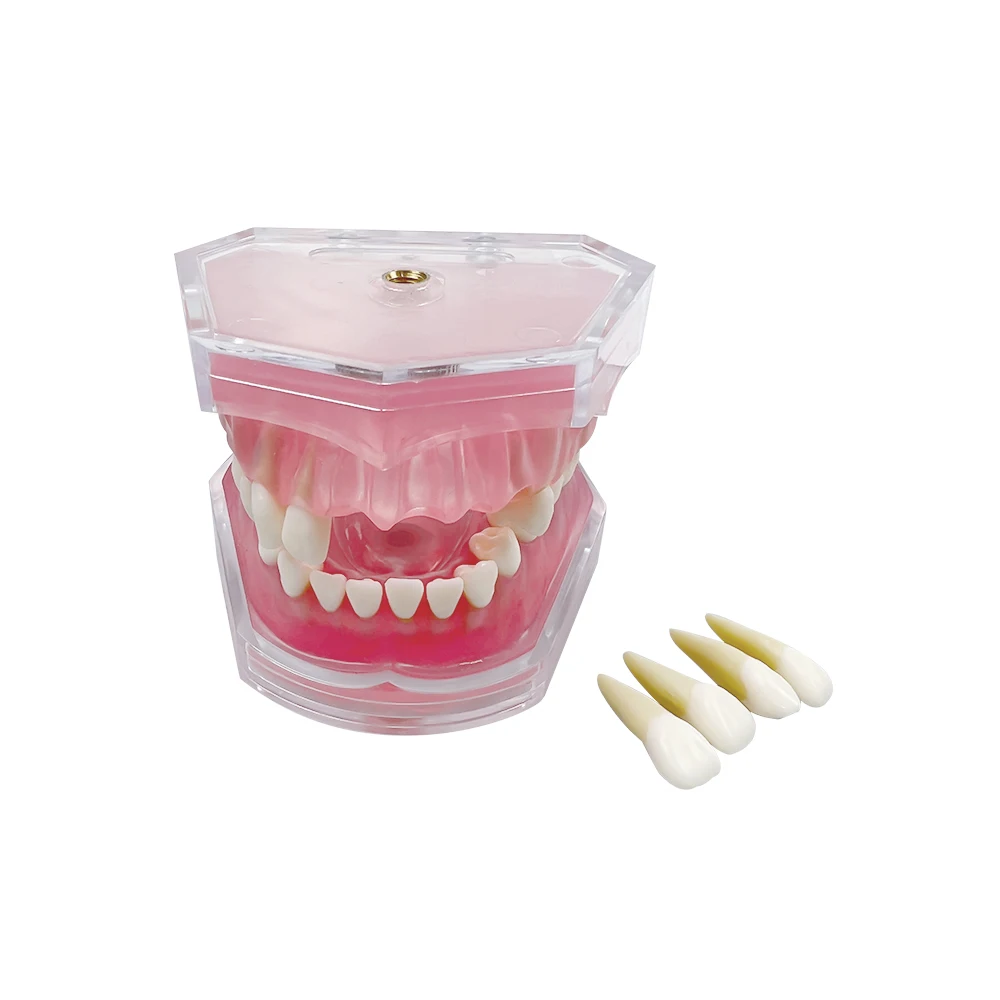 Dental Standard Typodont Teaching Model Removable Teeth Soft Gum Training Extraction Pratice Model Dentistry Study Demonstration