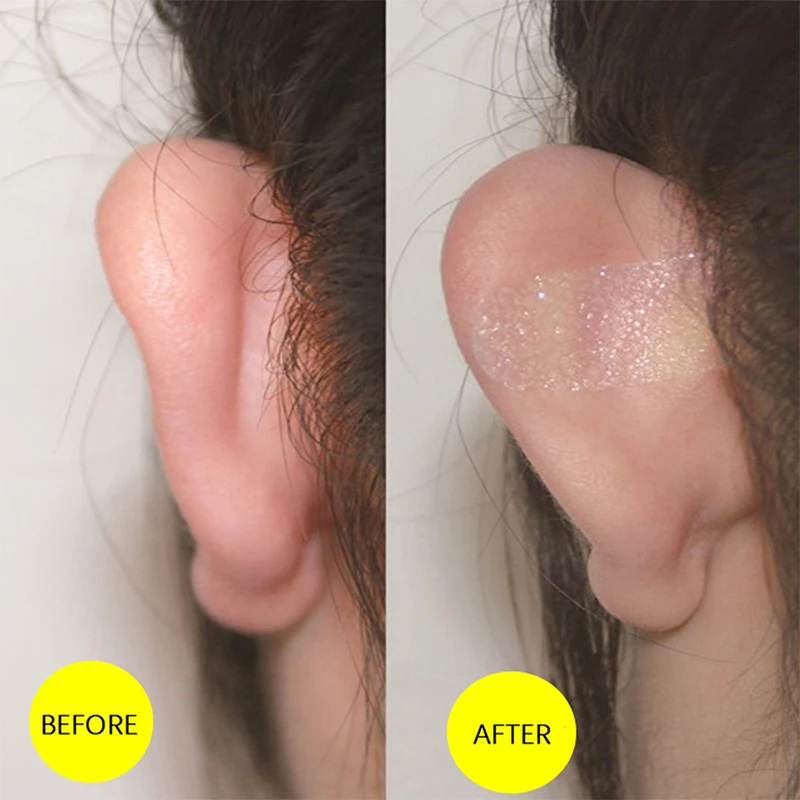 Z.18Pieces/Box Cosmetic Ear Corrector Elf Ear Stickers Ear Supporters Self Adhesive Cosmetic Ear Stickers Invisible Ear Stickers