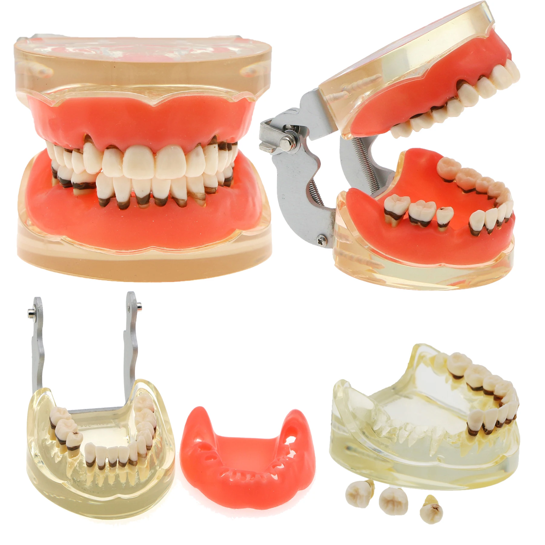 

Dental Teeth Model Dentist Teaching Model Demonstration Periodontal Disease Pathological For Patient Education Demo M4017