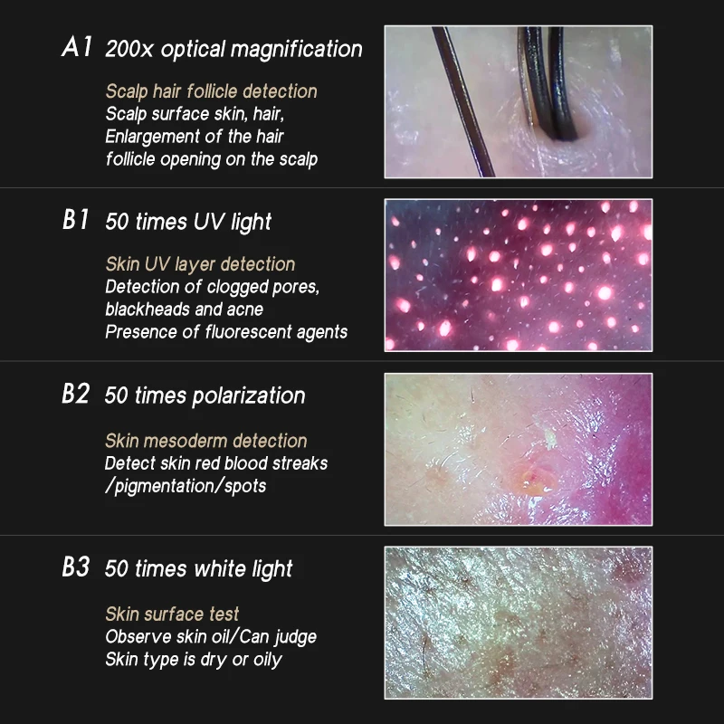 MEIBOYI Wireless Skin Analysis Device Portable Hair Scalp Skin Analyzer Mini Hair Follicles Detector Dermascope Beauty Salons
