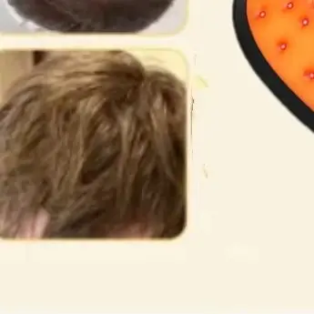 

Шапка для лазерной терапии с 96 лазерами 650 нм, красным светом, для роста волос, с умным датчиком, автоматическим отключением, портативная, USB, для домашнего использования, уход за кожей головы