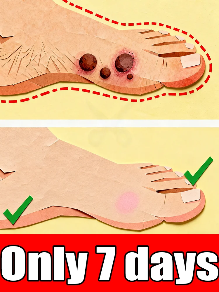 

Hᴏᴛ sᴇʟʟɪɴɢ ʙʟᴜᴇ ʟɪɢʜᴛ ᴘᴇɴ ᴛᴏ sᴏʟᴠᴇ ʙᴏᴅʏ ᴡᴀʀᴛs, ᴡᴀʀᴛ ᴄᴀʀᴇ ᴛᴏᴏʟs