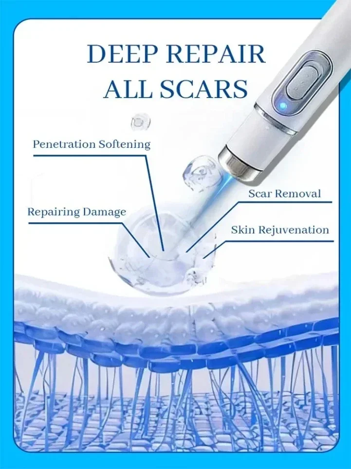 Effective for Old & New Scars on Face & Body| Pen for scars| Laser therapy Keloid scar|