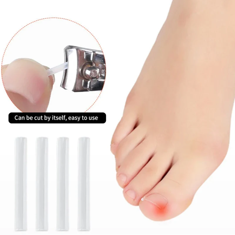 Ingrown Toenail Correction Tool Nail Filling Pad Ingrown Toe Nail Treatment Elastic Patch Straightening Clip Brace Pedicure Tool