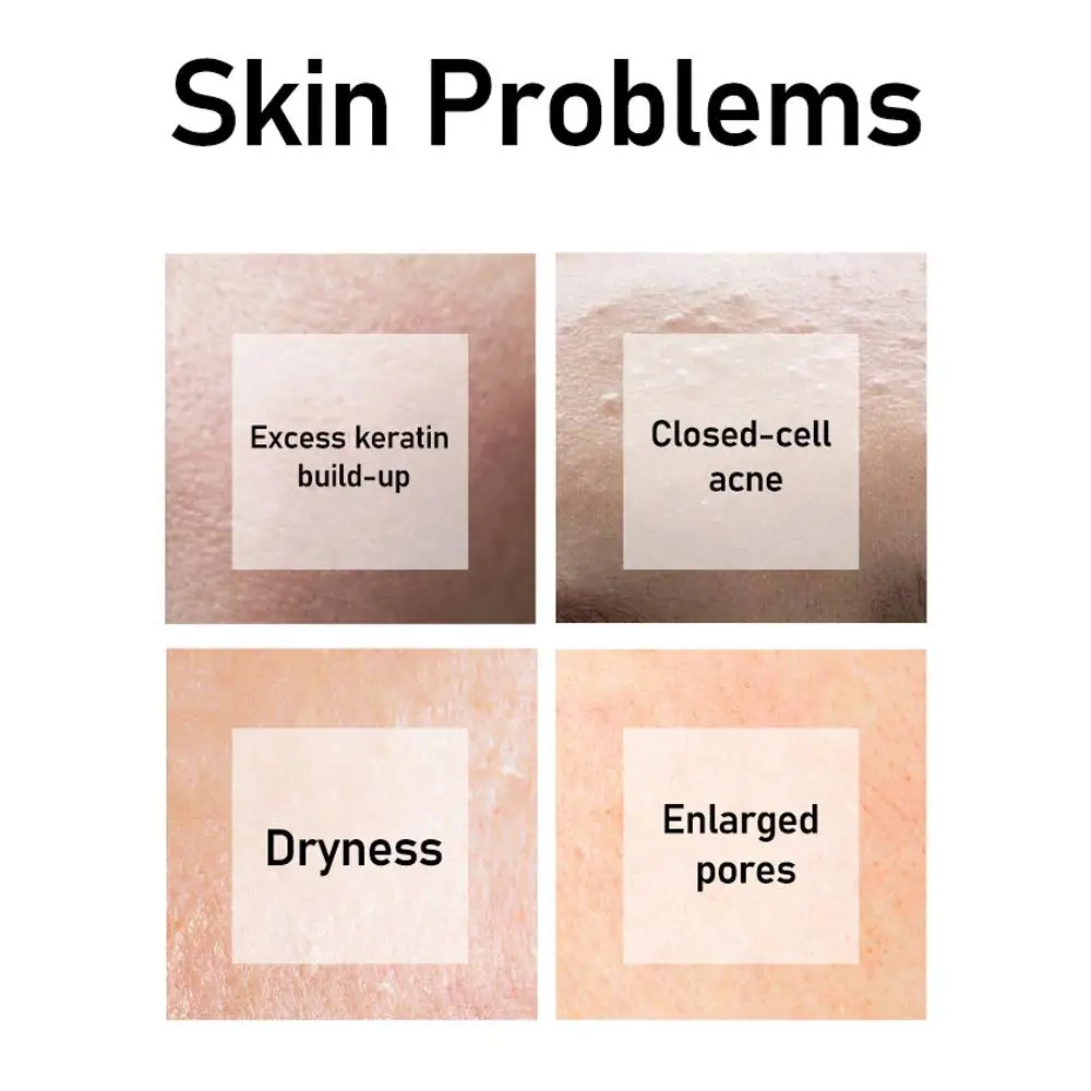 

30ml Salicylic Acid Pore Shrink Face Serum Repairs Large Pores Essence Anti-wrinkle Facial Serum Oil Control face Care